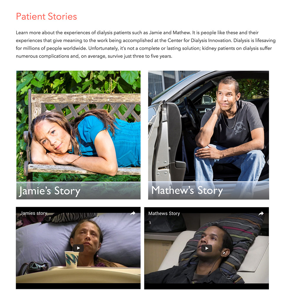 Center for Dialysis Innovation at the University of Washington: CDI Patient Stories Feature